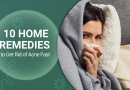 10 Home Remedies to Get Rid of Acne Fast