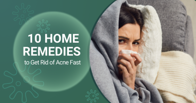 10 Home Remedies to Get Rid of Acne Fast
